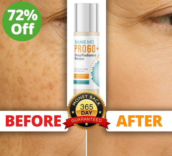PRO60+ DeepRadiance Renew | SANE MD | Dark Spot Remover - SANE:MD