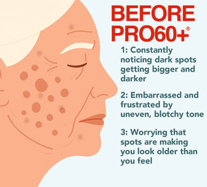 PRO60+ DeepRadiance Renew™